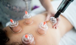 Exploring the Ancient Art: Unveiling the Wonders of Cupping Therapy