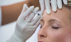 Smooth Forehead, Timeless Beauty: Unveiling the Power of Botox for Wrinkles