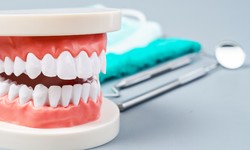The Role of a Root Canal Dentist