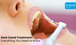 Say Goodbye to Tooth Pain: Root Canal Treatment at Face Kraft Clinic