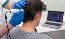 A Solution to Thinning Hair: Exploring the Benefits of Hair Growth Clinics