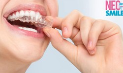 Invisalign for Teens: A Comprehensive Guide for Parents