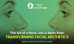 The art of a nose job is more than transforming facial aesthetics