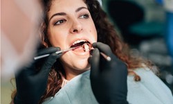 Finding Your Smile: A Guide to Choosing a Dentist in North Dallas