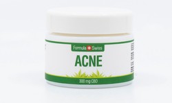 What's the Recommended Way to Use CBD as a Remedy for Acne?