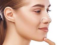 Does Rhinoplasty Surgery Leave Scars?