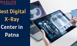 Understanding the Clear Benefits of Digital X-Ray at the Centre