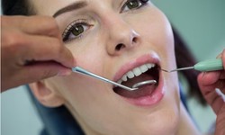 Navigating Your Dental Health: Finding the Right Dentist in North Dallas