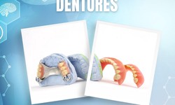Abbotsford Dentures: Tailored to Your Unique Needs