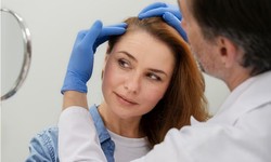 Transforming Your Look: The Power of Turkey Hair Transplant Clinics