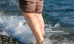 Title: Varicose Veins: A Comprehensive Guide to Understanding and Managing