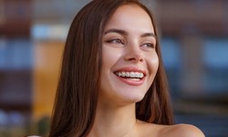 Your Journey to a Beautiful Smile: A Comprehensive Guide to Dental Braces"