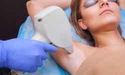 Laser Hair Removal: Benefits, Side Effects, and Cost | 3D Lifestyle