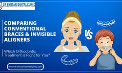 Comparing Conventional Braces & Invisible Aligners: Which Orthodontic Treatment is right for you?