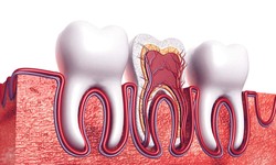 The Ultimate Guide To Finding The Best Root Canal Specialist