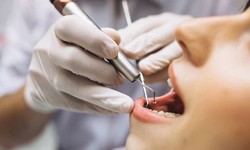 The Secrets to a Healthy Smile: Roswell Dentistry Revealed