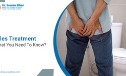 Piles Treatment – What You Need To Know?