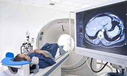 Enhance Your Healthcare with Vitalrad's Best Teleradiology Services