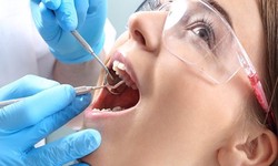 Understanding Root Canal Treatment: Procedure, Benefits, and Aftercare