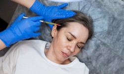 Dry Confidence: Exploring the Wonders of Botox for Hyperhidrosis Relief