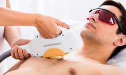 Chest Hair Removal Tysons Corner VA with Best Laser Technology