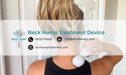 Non-Surgical Approaches to Addressing a Buffalo Hump at Home