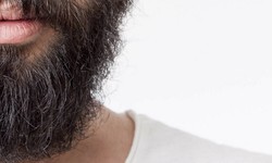 Men's Beard Transplants and Facial Hair Solutions in Narberth