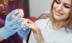 Demystifying Dental Aligners: The Science, Savings, and Truth Behind Aligner Treatment