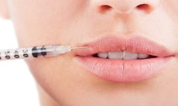 Enhance Your Beauty with Lip Filler and Dermal Filler Packages in London