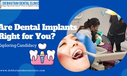 Are Dental Implants Right for You? Exploring Candidacy