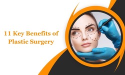 11 Key Benefits of Plastic Surgery