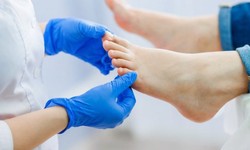 Effective Nail Fungus Treatment in Australia: A Path to Healthy Nails