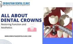 All About Dental Crowns: Restoring Function and Aesthetics