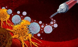 Dendritic Cell Therapy: Reengaging the Power of the Immune System in Cancer Treatment