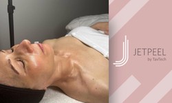 Is Jet Peel Skin Treatment Right for You? A Comprehensive Guide