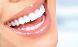 Brighter Smiles: Exploring the Benefits of Teeth Whitening