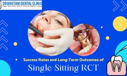 Success Rates and Long-Term Outcomes of Single-Sitting RCT