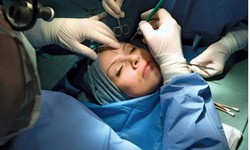 The Ultimate Guide to Cosmetic Surgery in Turkey