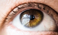 Understanding Dry Eyes: Causes, Symptoms, and Treatment Options