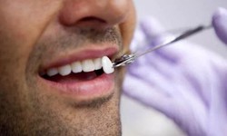 Dental Veneers Help to Enhance Your Appearance by Camouflaging Cosmetic Flaws