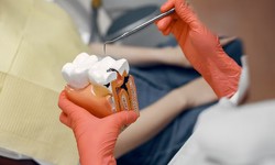 Rockwall's Kiddie Dental Haven: Finding the Perfect Pediatric Dentist