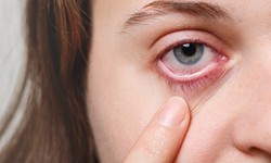 Glaucoma: The Silent Vision Thief and Its Early Detection
