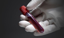 How to Compare Blood Tests for Body Analysis at Home Costs