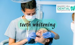 Whitening Your Teeth: 12 Easy (and Safe) Methods
