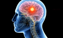 Traumatic Brain Injuries: How to Cope and Move Forward