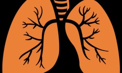 Lung Cancer Treatment in Gurgaon