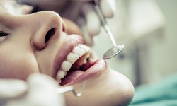 Emergency Dental Care in Croydon: Your Go-To Resource in Crisis