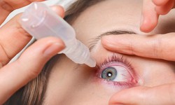 The Correct Way to Put Medicine in Your Eyes: Tips and Techniques