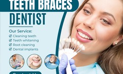 Teeth Braces: A Practical Guide to Oral Hygiene