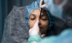 London's Premier Non-Surgical Nose Job: Enhance Your Profile Safely
